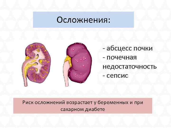 Осложнения: - абсцесс почки - почечная недостаточность - сепсис Риск осложнений возрастает у беременных