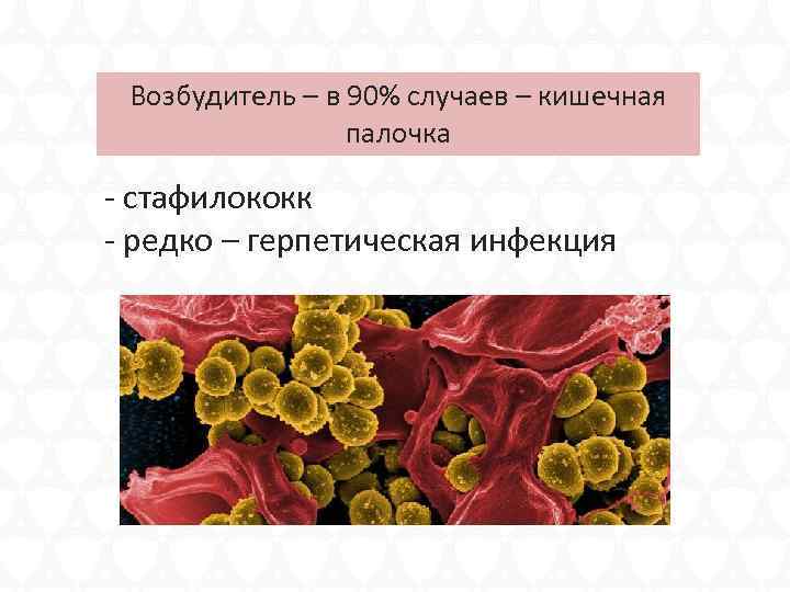 Возбудитель – в 90% случаев – кишечная палочка - стафилококк - редко – герпетическая