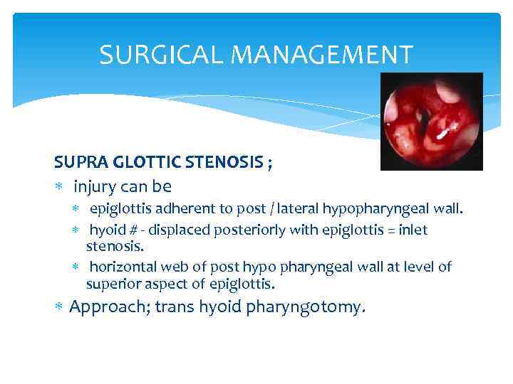 SURGICAL MANAGEMENT SUPRA GLOTTIC STENOSIS ; injury can be epiglottis adherent to post /