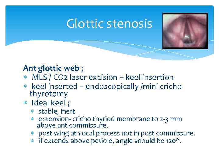 Glottic stenosis Ant glottic web ; MLS / CO 2 laser excision – keel