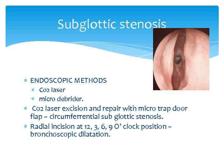 Subglottic stenosis ENDOSCOPIC METHODS Co 2 laser micro debrider. Co 2 laser excision and