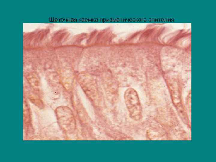 Щеточная каемка призматического эпителия 