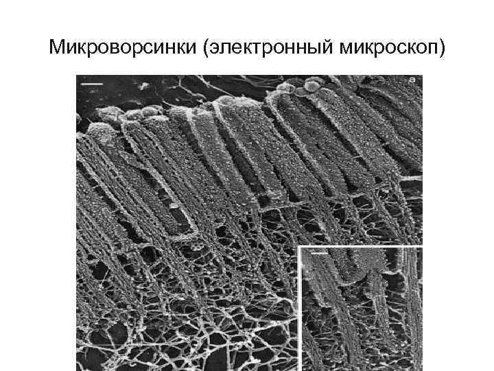 Микроворсинки (электронный микроскоп) 