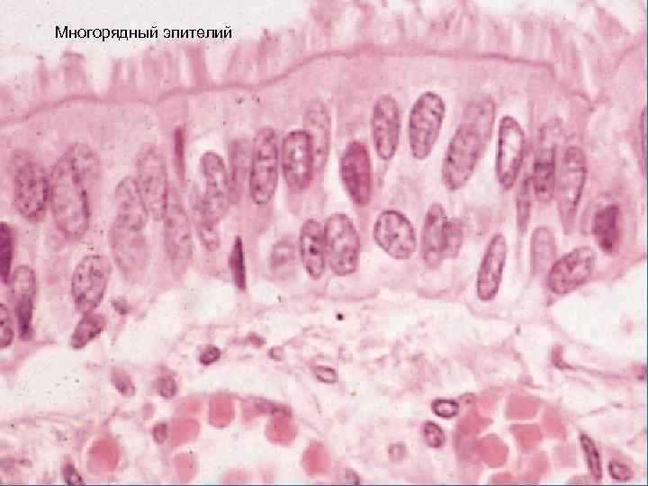 Многорядный эпителий 