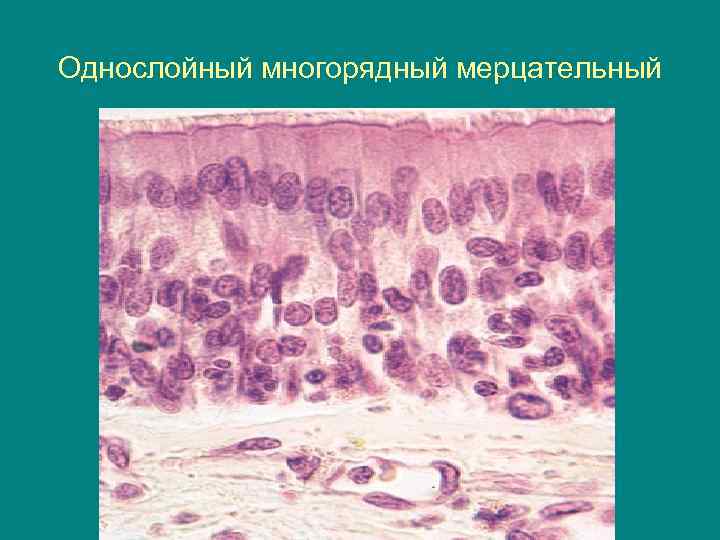 Однослойный многорядный мерцательный 