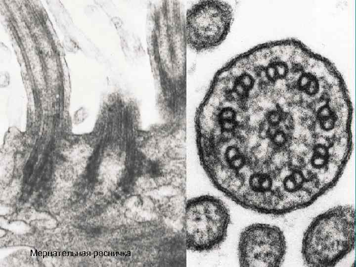 Мерцательная ресничка 