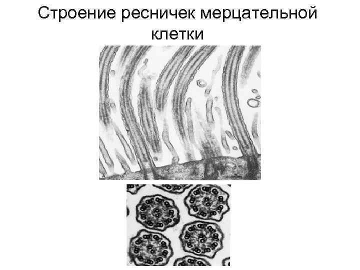 Строение ресничек мерцательной клетки 