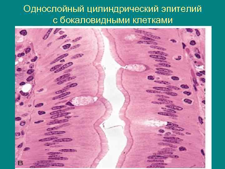 Однослойный цилиндрический эпителий с бокаловидными клетками 
