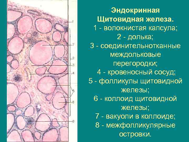 Эндокринная Щитовидная железа. 1 - волокнистая капсула; 2 - долька; 3 - соединительнотканные междольковые