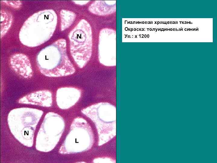 Гиалиновая хрящевая ткань Окраска: толуидиновый синий Ув. : х 1200 
