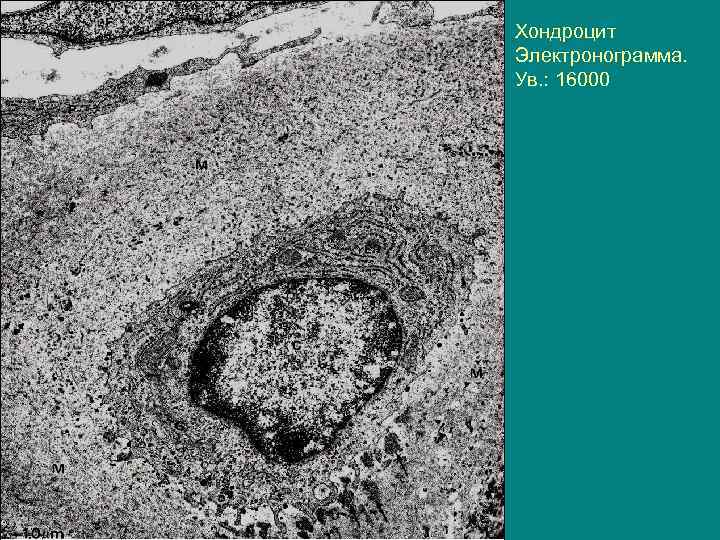 Хондроцит Электронограмма. Ув. : 16000 