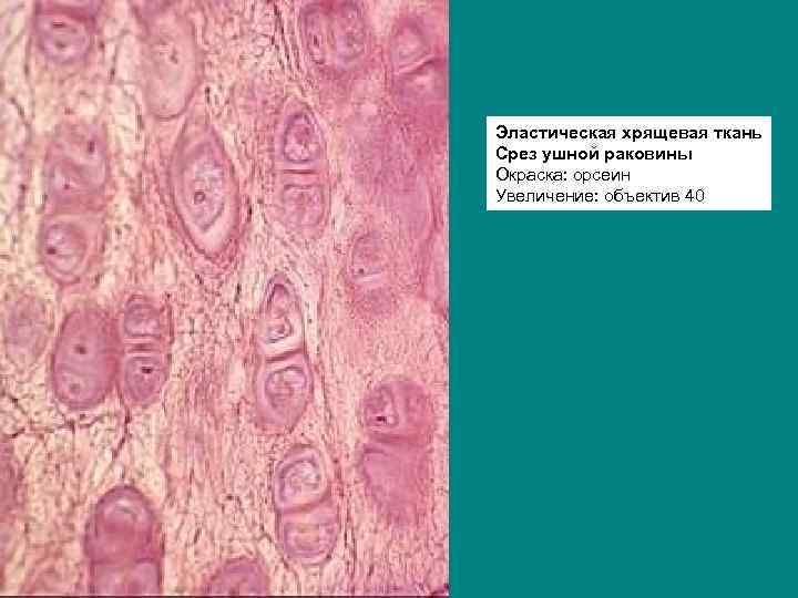 Аппозиционный рост хряща. Эластический хрящ гистология. Эластический хрящ ушной раковины препарат. Хрящевая ткань эластический хрящ. Эластическая хрящевая ткань. Срез ушной раковины. Окраска: орсеин.