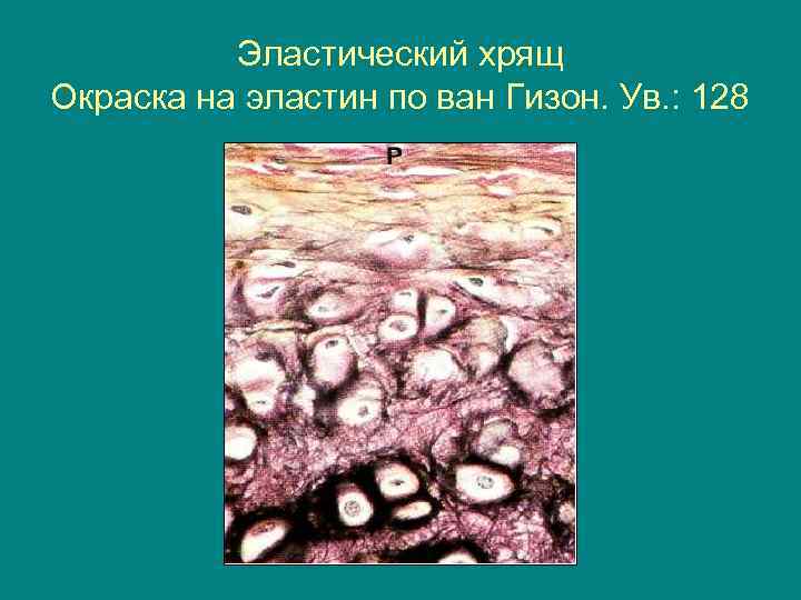 Эластический хрящ Окраска на эластин по ван Гизон. Ув. : 128 