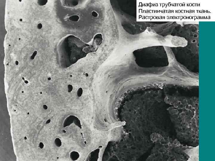 Диафиз трубчатой кости Пластинчатая костная ткань. Растровая электронограмма 