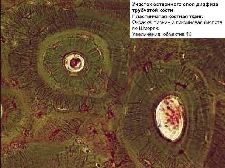 Участок остеонного слоя диафиза трубчатой кости Пластинчатая костная ткань Окраска: тионин и пикриновая кислота