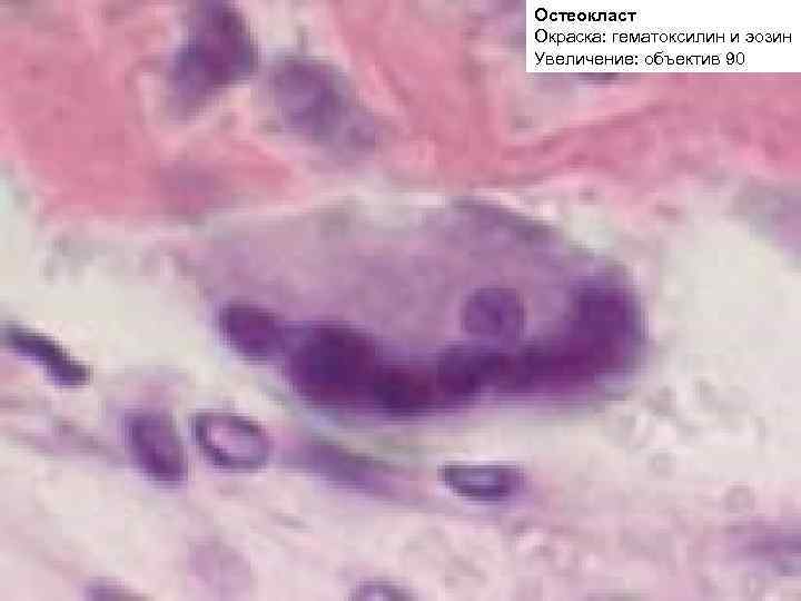 Остеокласт Окраска: гематоксилин и эозин Увеличение: объектив 90 