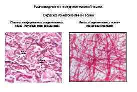 Разновидности соединительной ткани. Окраска: гематоксилин и эозин. Плотная неоформленная соединительная ткань - сетчатый слой