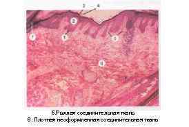 5. Рыхлая соединительная ткань 6. Плотная неоформленная соединительная ткань 
