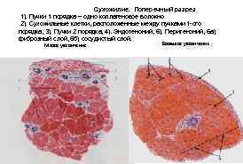 Сухожилие. Поперечный разрез 1). Пучки 1 порядка – одно коллагеновое волокно 2). Сухожильные клетки,