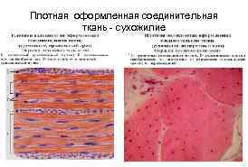 Плотная оформленная соединительная ткань - сухожилие 