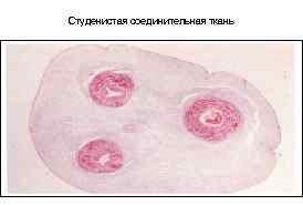 Студенистая соединительная ткань 