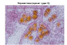 Жировая ткань (окраска: судан III) 