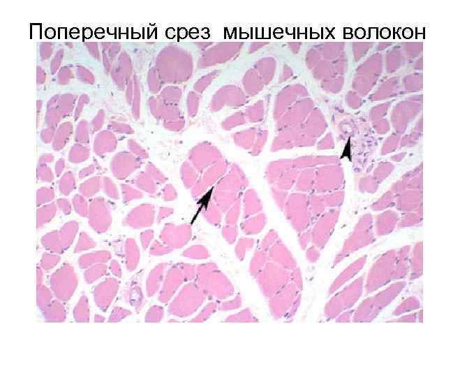 Поперечный срез мышечных волокон 