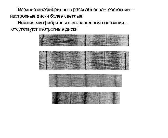 Верхние миофибриллы в расслабленном состоянии – изотропные диски более светлые Нижние миофибриллы в сокращенном