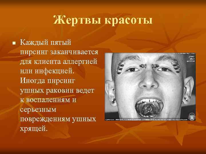 Жертвы красоты n Каждый пятый пирсинг заканчивается для клиента аллергией или инфекцией. Иногда пирсинг