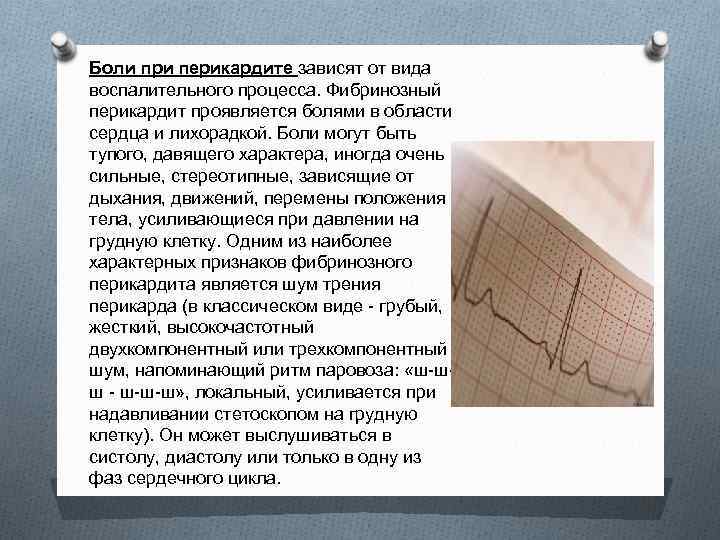 Боли при перикардите зависят от вида воспалительного процесса. Фибринозный перикардит проявляется болями в области