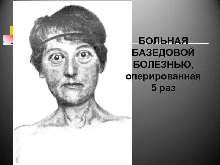 БОЛЬНАЯ БАЗЕДОВОЙ БОЛЕЗНЬЮ, оперированная 5 раз 