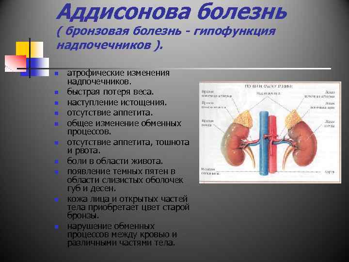 Аддисонова болезнь ( бронзовая болезнь - гипофункция надпочечников ). n n n n n