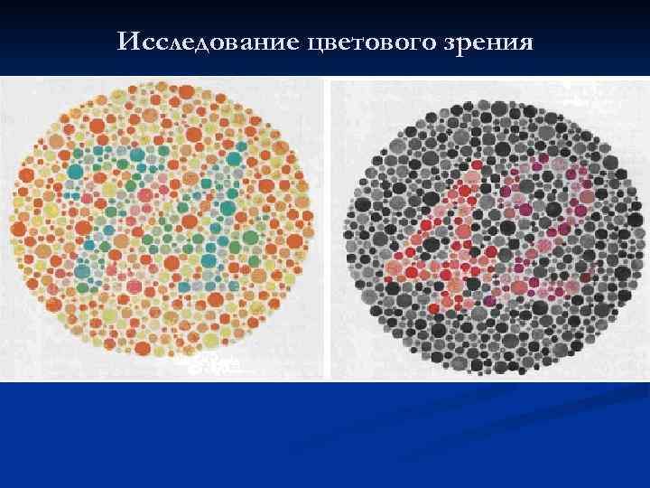Исследование цветового зрения 