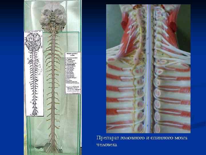 Препарат головного и спинного мозга человека 