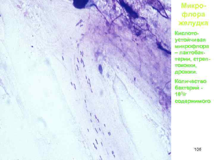 Микрофлора желудка Кислотоустойчивая микрофлора – лактобактерии, стрептококки, дрожжи. Количество бактерий 103/г содержимого 106 