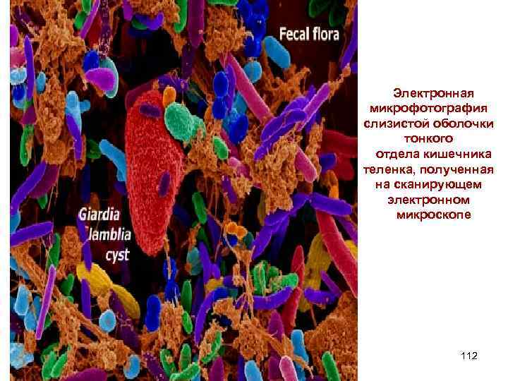 Электронная микрофотография слизистой оболочки тонкого отдела кишечника теленка, полученная на сканирующем электронном микроскопе 112