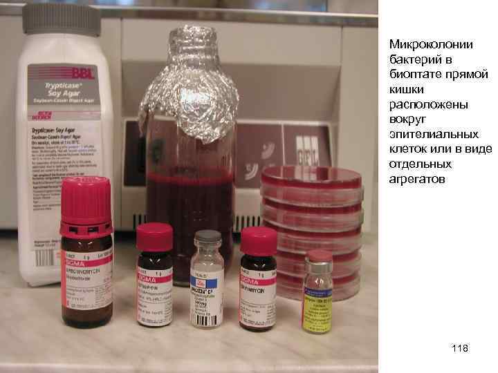 Микроколонии бактерий в биоптате прямой кишки расположены вокруг эпителиальных клеток или в виде отдельных