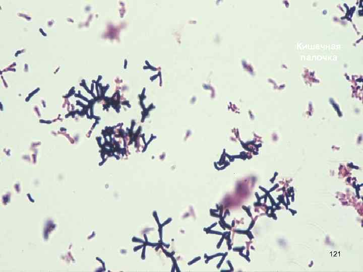Кишечная палочка 121 
