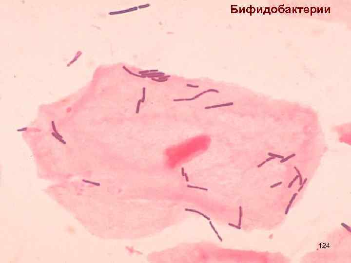 Бифидобактерии 124 