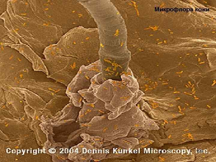 Микрофлора кожи 129 