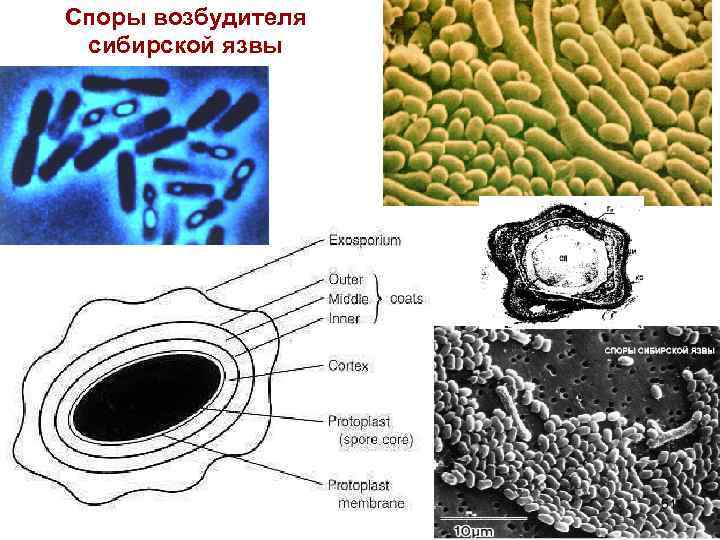 Сколько живут споры. Споры сибирской язвы микробиология. Споры бацилл сибирской язвы. Сибирская язва строение бактерии. Споры сибирской язвы под микроскопом.