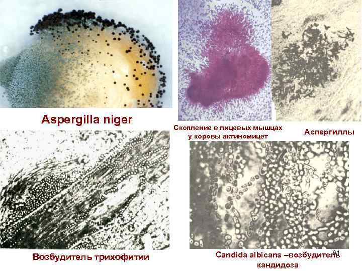 Aspergilla niger Возбудитель трихофитии Скопление в лицевых мышцах у коровы актиномицет Аспергиллы 61 Candida
