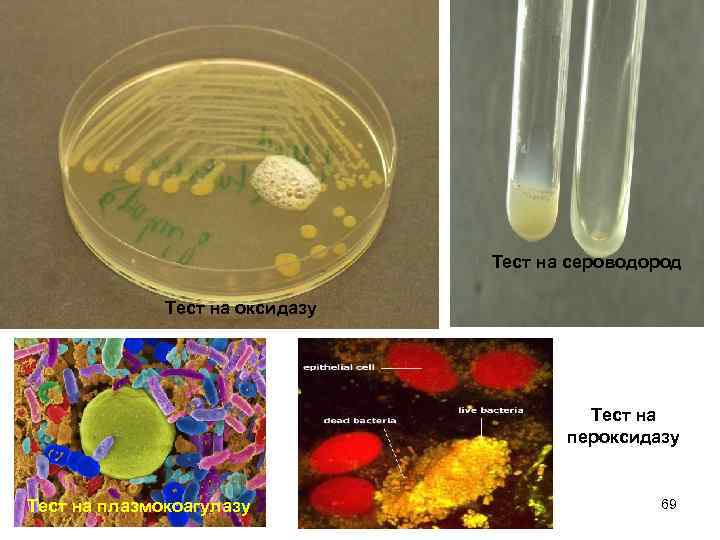 Тест на сероводород Тест на оксидазу Тест на пероксидазу Тест на плазмокоагулазу 69 