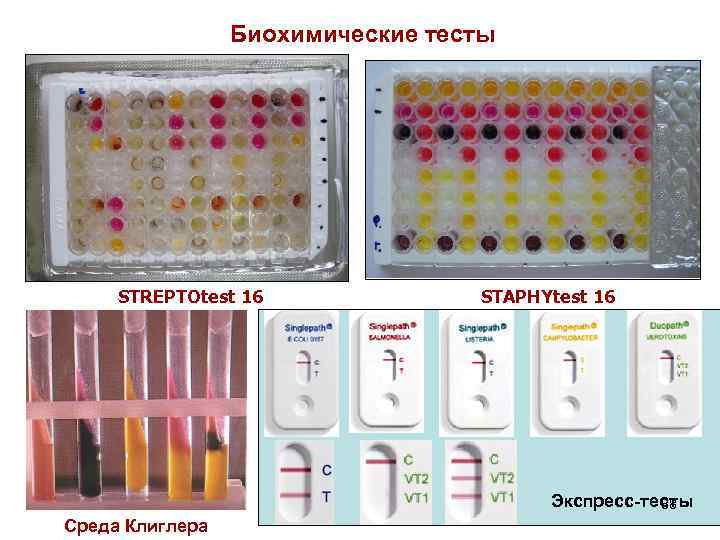 Биохимические тесты STREPTOtest 16 STAPHYtest 16 Экспресс-тесты 88 Среда Клиглера 