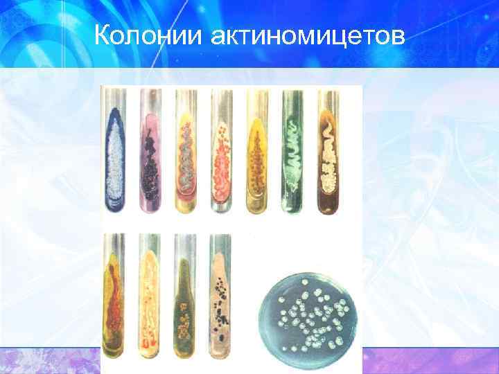 Колонии актиномицетов 