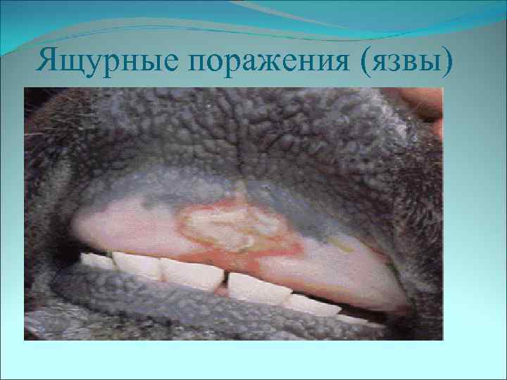 Ящурные поражения (язвы) 