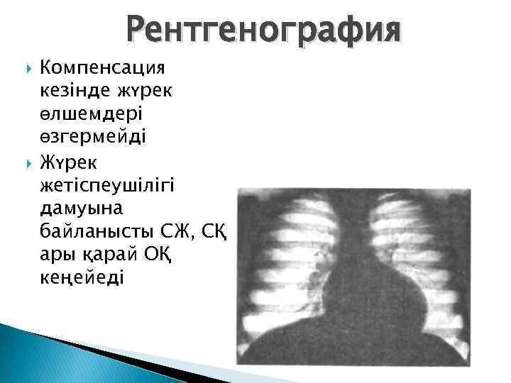 Рентгенография Компенсация кезінде жүрек өлшемдері өзгермейді Жүрек жетіспеушілігі дамуына байланысты СЖ, СҚ ары қарай