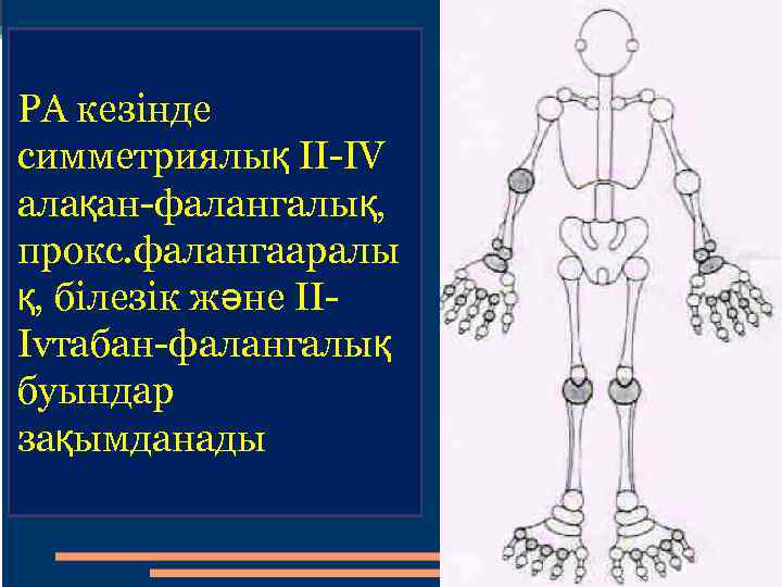 РА кезінде симметриялық II-IV алақан-фалангалық, прокс. фалангааралы қ, білезік және IIIvтабан-фалангалық буындар зақымданады 