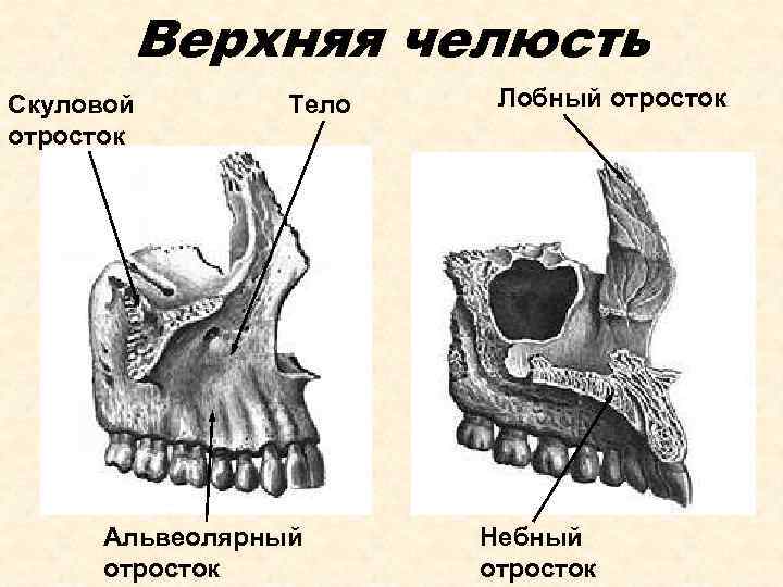 Верхняя челюсть Скуловой отросток Тело Альвеолярный отросток Лобный отросток Небный отросток 