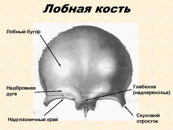 Лобные бугры при рахите фото